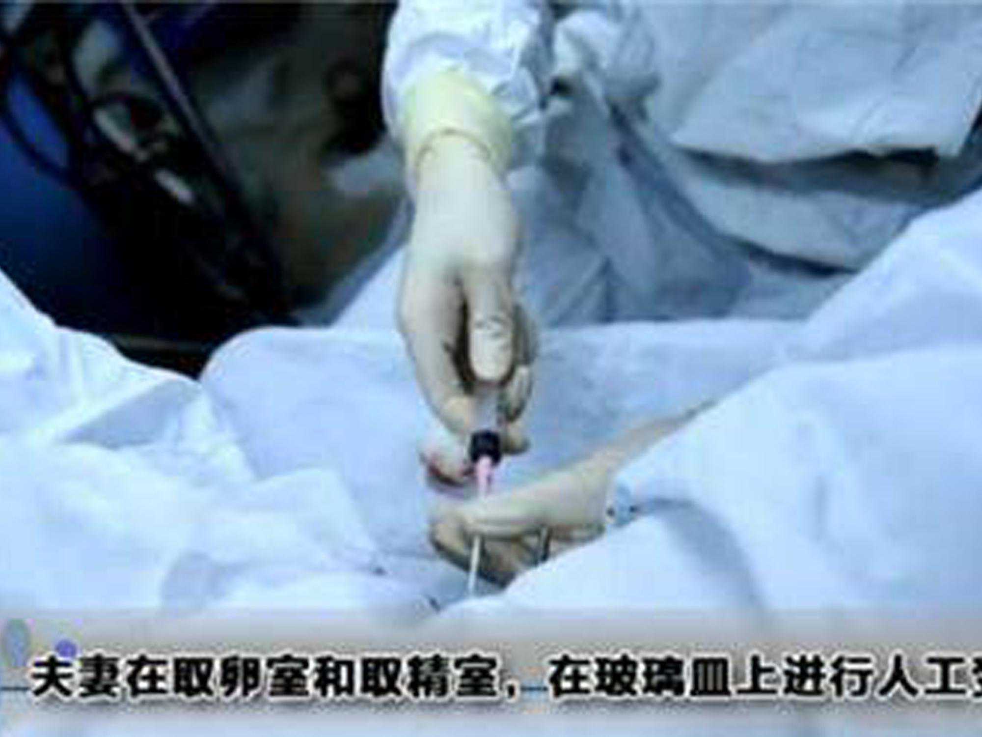 试管婴儿过程中，哪个步骤最考验人，几张图片“播放”真相