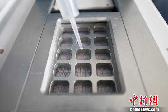 探访生殖中心实验室：试管婴儿可早期阻断遗传病基因