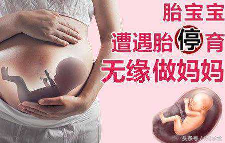 造成胎停育的原因就这两类，提前早知道好备孕！